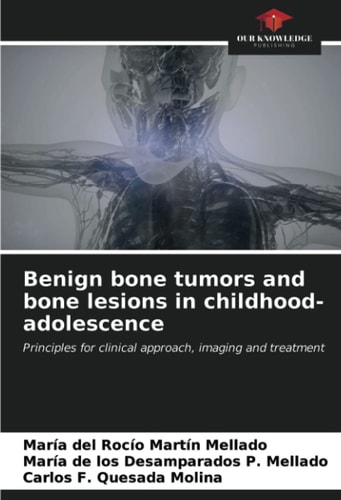 Benign bone tumors and bone lesions in childhood-adolescence: Principles for clinical approach, imaging and treatment