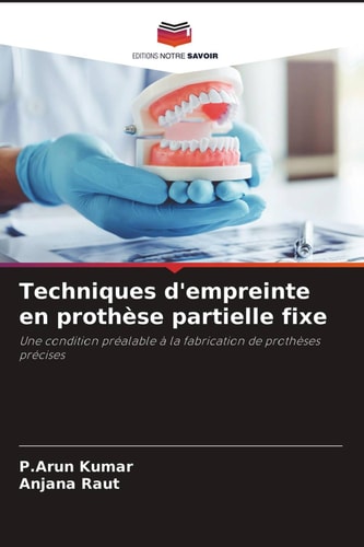 Techniques d'empreinte en prothèse partielle fixe: Une condition préalable à la fabrication de prothèses précises (French Edition)