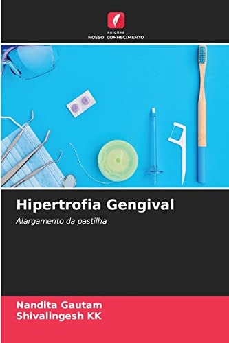 Hipertrofia Gengival: Alargamento da pastilha (Portuguese Edition)