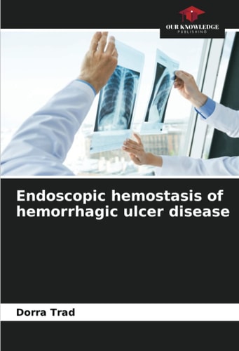 Endoscopic hemostasis of hemorrhagic ulcer disease