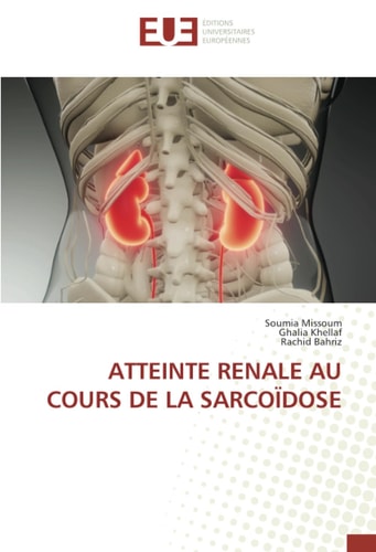 ATTEINTE RENALE AU COURS DE LA SARCOÏDOSE (French Edition)