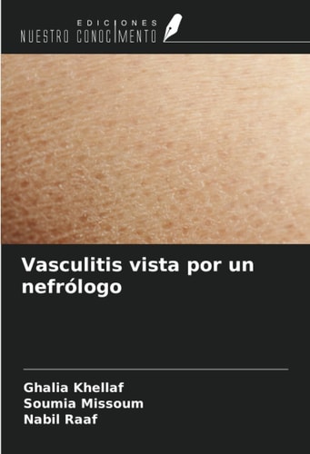 Vasculitis vista por un nefrólogo (Spanish Edition)