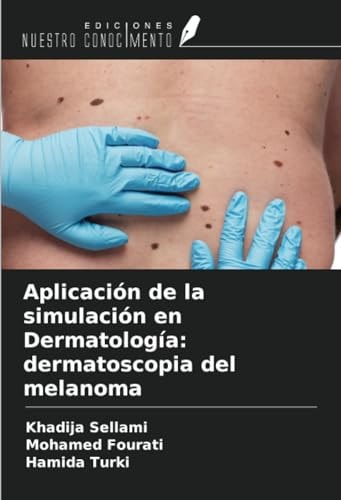 Aplicación de la simulación en Dermatología: dermatoscopia del melanoma (Spanish Edition)