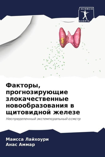 Факторы, прогнозирующие злокачественные новообразования в щитовидной железе: Неопределенный экстемпоральный осмотр (Russian Edition)