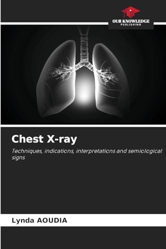 Chest X-ray