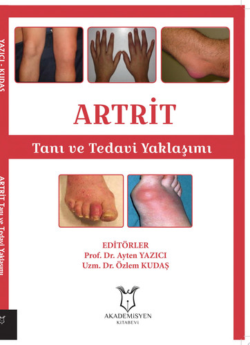 ARTRİT Tanı ve Tedavi Yaklaşımı