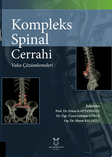 Kompleks Spinal Cerrahi: Vaka Çözümlemeleri