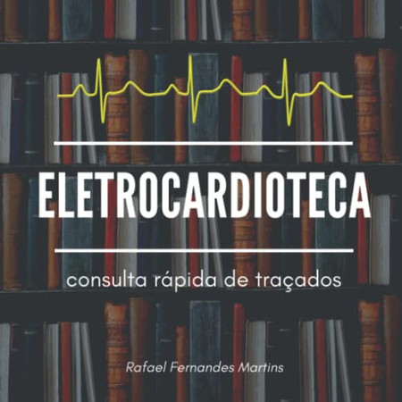 Eletrocardioteca consulta rápida de traçados