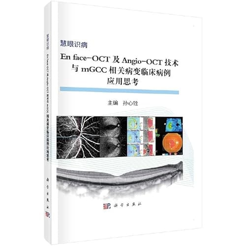 En face-OCT ji Angio-OCT ji shu yu mGCC xiang guan bing bian lin chuang bing li ying yong si kao