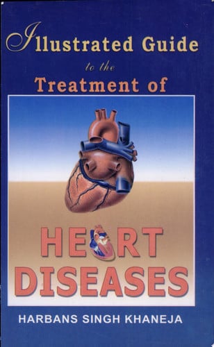 Illustrated Guide to the Treatment of Heart Diseases