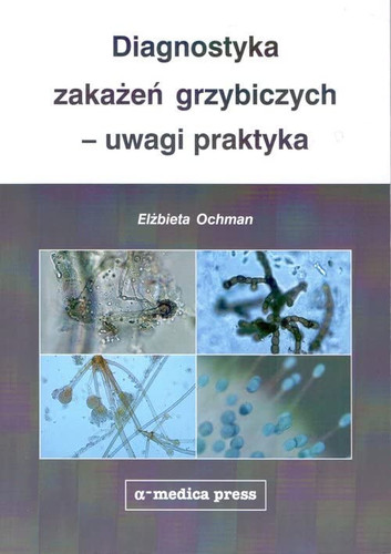 Diagnostyka zakazen grzybiczych uwagi praktyka