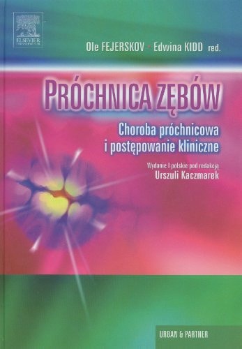 Próchnica zębów choroba próchnicowa i postępowanie kliniczne