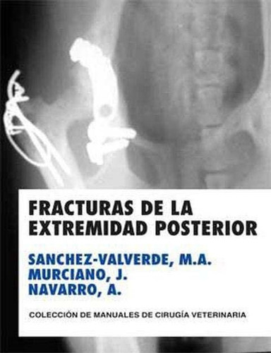 Fractura de la extremidad posterior