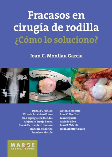 Fracasos en cirugía de rodilla (Spanish Edition)