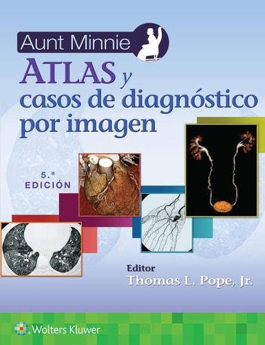Aunt Minnie. Atlas y Casos de Diagnóstico Por Imagen