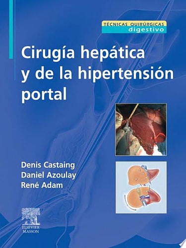 Cirugía hepática y de la hipertensión portal