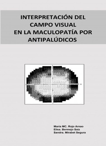 INTERPRETACIÓN DEL CAMPO VISUAL EN LA MACULOPATÍA POR ANTIPALÚDICOS