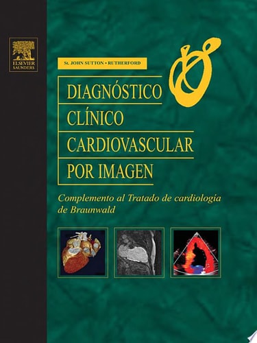 Diagnóstico Clínico Cardiovascular Por Imagen Complemento Al Tratado de Cardiología de Braunwald