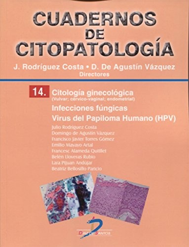 Citología ginecológica : infecciones fúngicas : virus del papiloma humano (HPV)