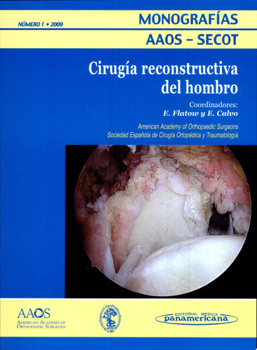 Cirugía reconstructiva del hombro