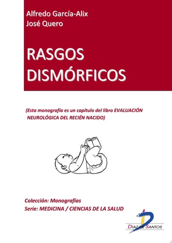 Rasgos dismórficos Evaluación neurológica del recién nacido