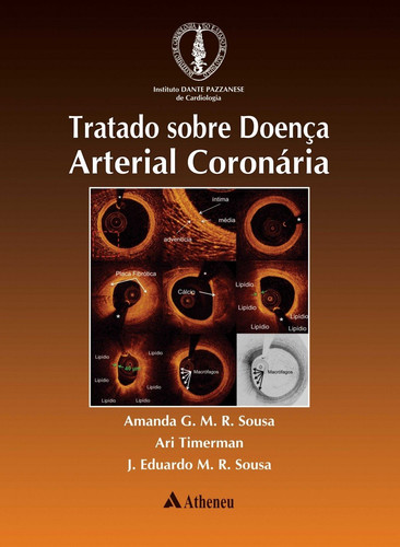 Tratado Sobre Doença Arterial Coronária