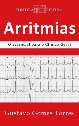 Arritmias: o essencial para o clínico geral - arritmia, marca-passo, cardiologia, emergência, estimulação artificial, eletrocardiograma, ecg, eletrocardiografia
