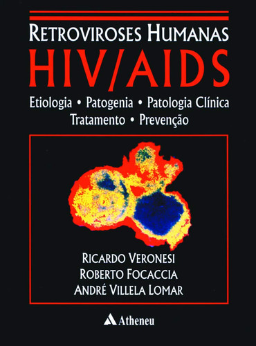 HIVIAIDS