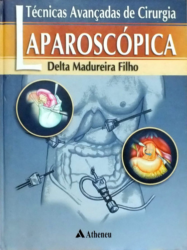 TÉCNICAS AVANÇADAS DE CIRURGIA LAPAROSCÓPICA