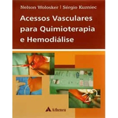 ACESSOS VASCULARES PARA QUIMIOTERAPIA E HOMODIÁLISE
