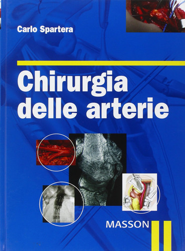 Chirurgia delle arterie