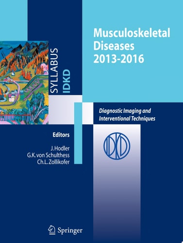 Musculoskeletal Diseases 2013-2016