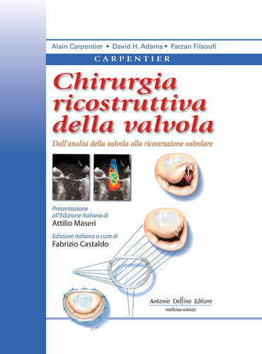 Chirurgia Ricostruttiva Della Valvola Mitrale.
