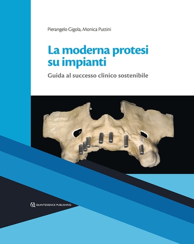 La moderna protesi su impianti Guida al successo clinico sostenibile