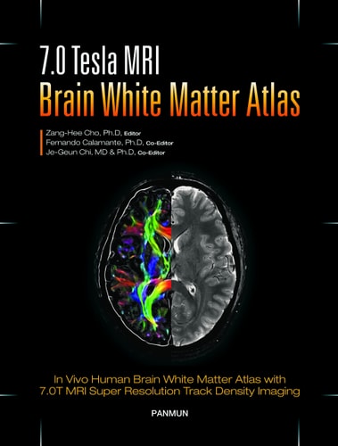 7.0 Tesla MRI Brain White Matter Atlas