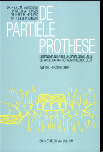 De partiële prothese Uitgangsp. by diagn. en behandeling gemutileerde gebit