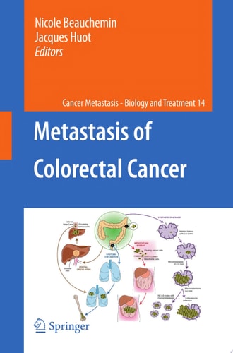 Metastasis of Colorectal Cancer