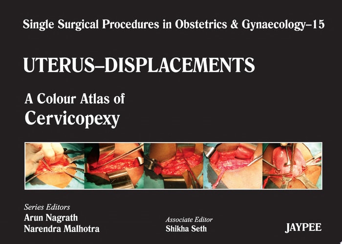 Single Surgical Procedures in Obstetrics and Gynaecology–15: A Colour Atlas of Cervicopexy (Purandare’s) A Colour Atlas of Cervicopexy
