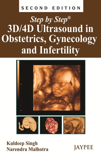 Step by Step: 3D/4D Ultrasound in Obstetrics, Gynecology and Infertility