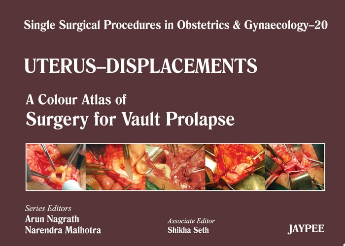 Single Surgical Procedures in Obstetrics and Gynaecology-20 A Colour Atlas of Surgery for Vault Prolapse
