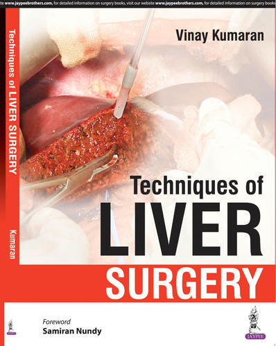 Techniques of Liver Surgery