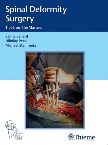 Spinal Deformity Surgery