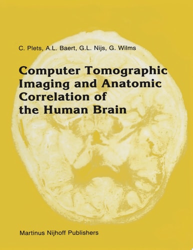 Computer Tomographic Imaging and Anatomic Correlation of the Human Brain A comparative atlas of thin CT-scan sections and correlated neuro-anatomic preparations