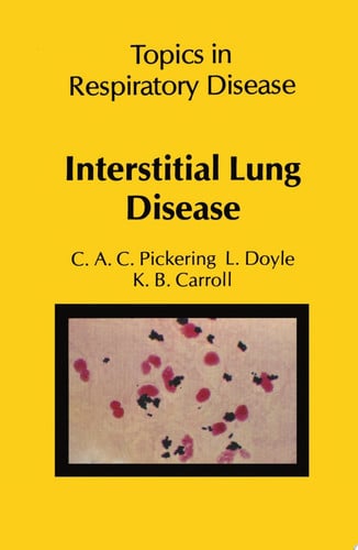 Interstitial Lung Disease