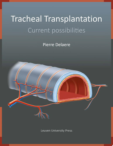 Tracheal Transplantation