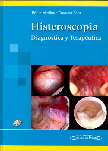 Histeroscopia diagnóstica y terapéutica