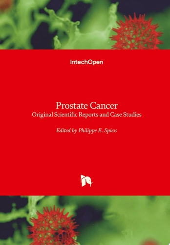 Prostate Cancer Original Scientific Reports and Case Studies