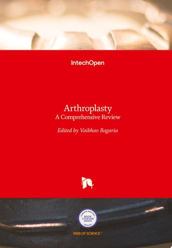 Arthroplasty A Comprehensive Review