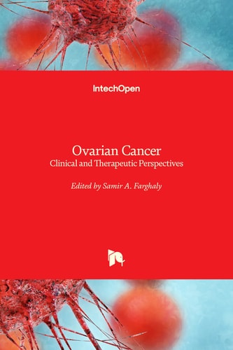 Ovarian Cancer Clinical and Therapeutic Perspectives
