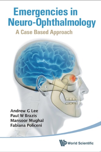 Emergencies In Neuro-ophthalmology: A Case Based Approach